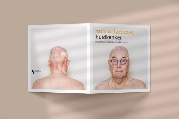 Nationaal Actieplan Huidkanker - Mauritskliniek