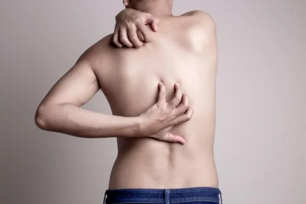 Dermatologie | Constitutioneel Eczeem - Mauritskliniek