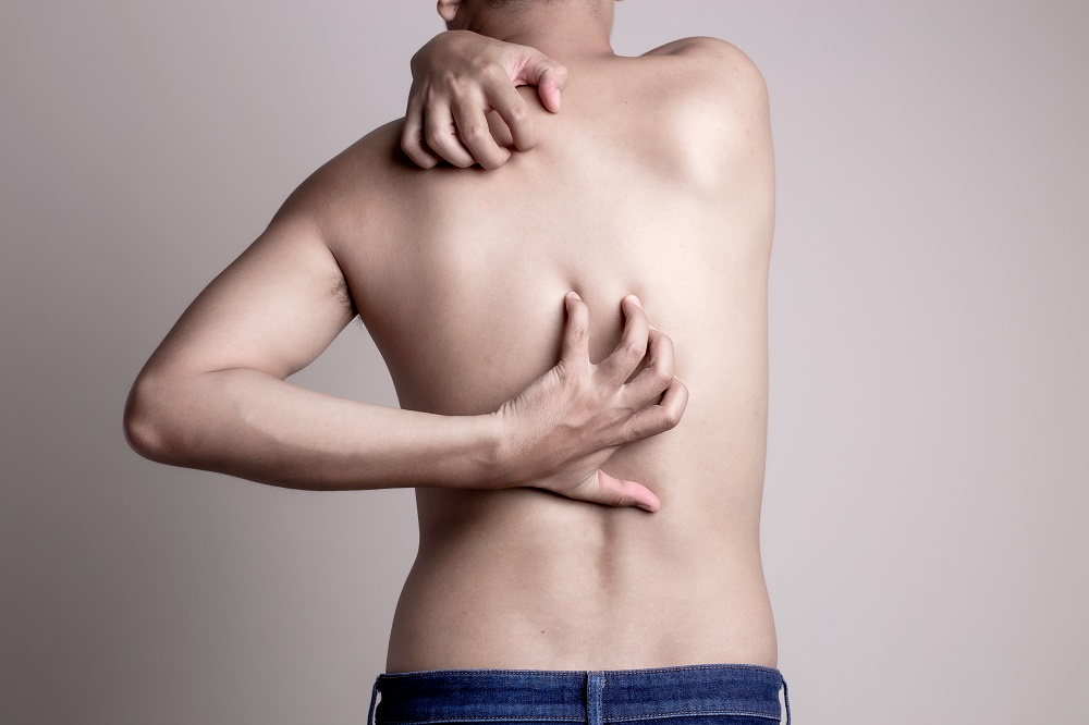 Dermatologie | Constitutioneel Eczeem - Mauritskliniek