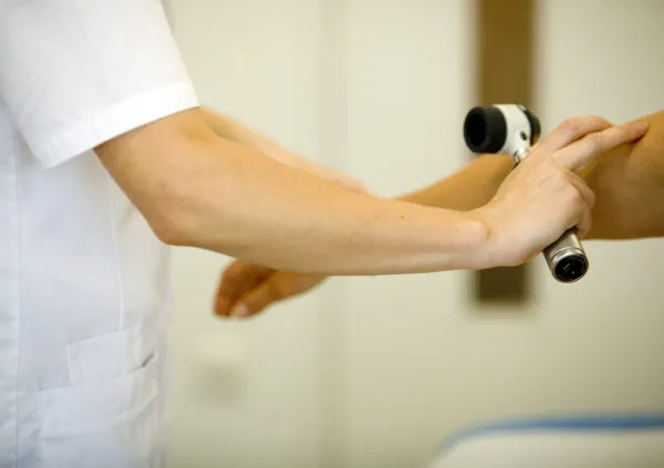 Dermatoscoop huidkanker controle Mauritskliniek