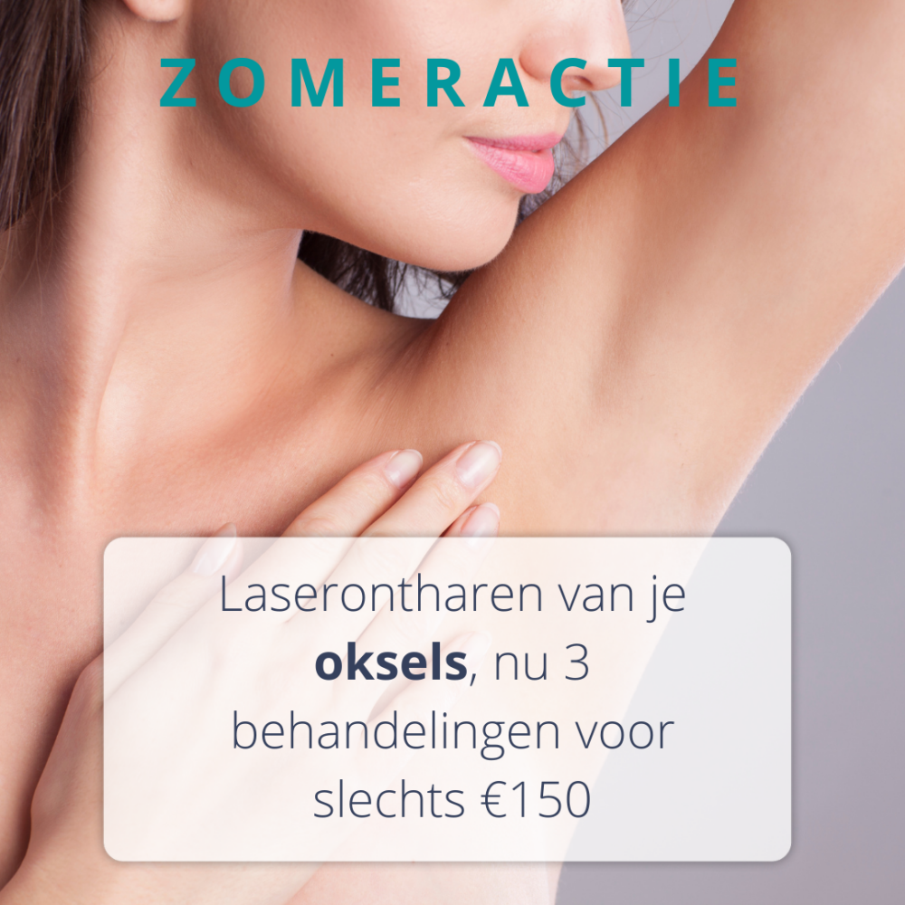 Zomeractie Laserontharen