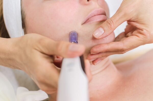 Dermapen huidtherapie Mauritskliniek